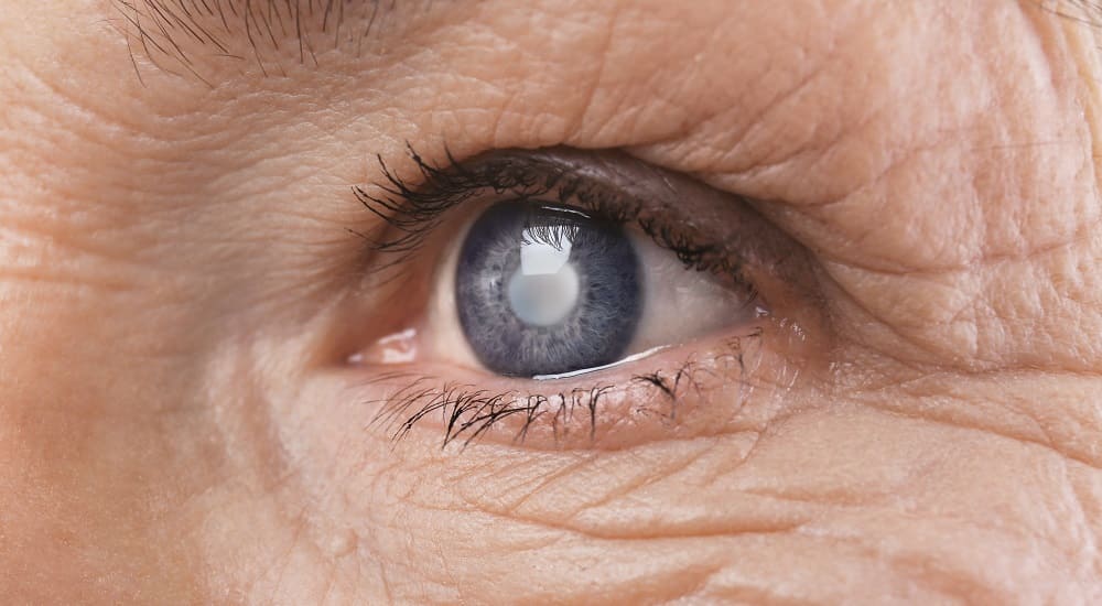 choroby siatkówki oka - jaskra